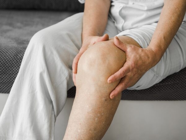 De knie
